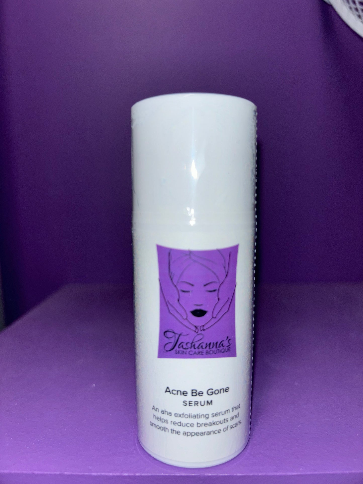 Acne Be Gone Serum - 1 oz